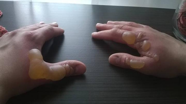 Zasady bezpieczeństwa stosowania LPG